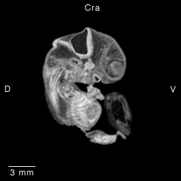 MRI Slice Images