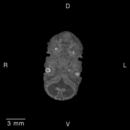 MRI Slice Images