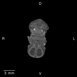 MRI Slice Images