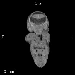 MRI Slice Images