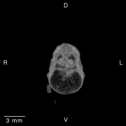 MRI Slice Images