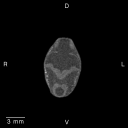 MRI Slice Images