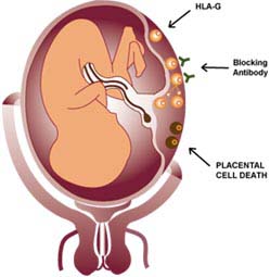 HLA-G, Blocking Antibody and Placental Cell Death Explained
