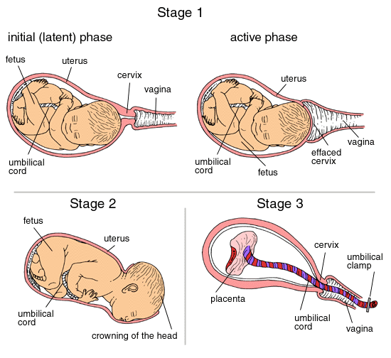 stages.gif (54425 bytes)